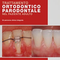Trattamento ortodontico parodontale nel paziente adulto. Un percorso clinico integrato