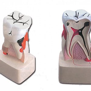 Modello patologia dentale